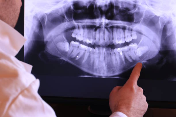 Best Emergency Treatment for Jaw Pain or Injury in West Liberty, OH